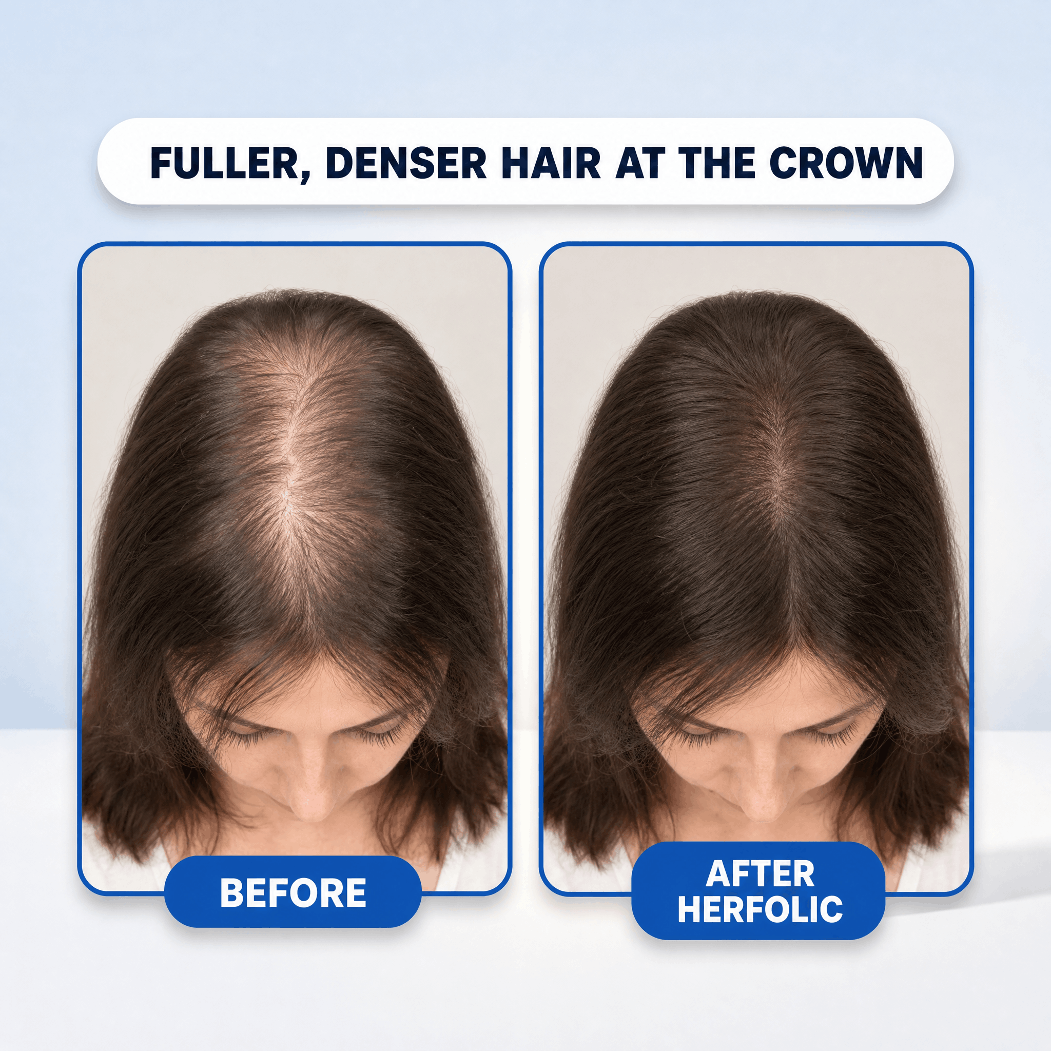 Peptide Infusion Hair Regrowth System