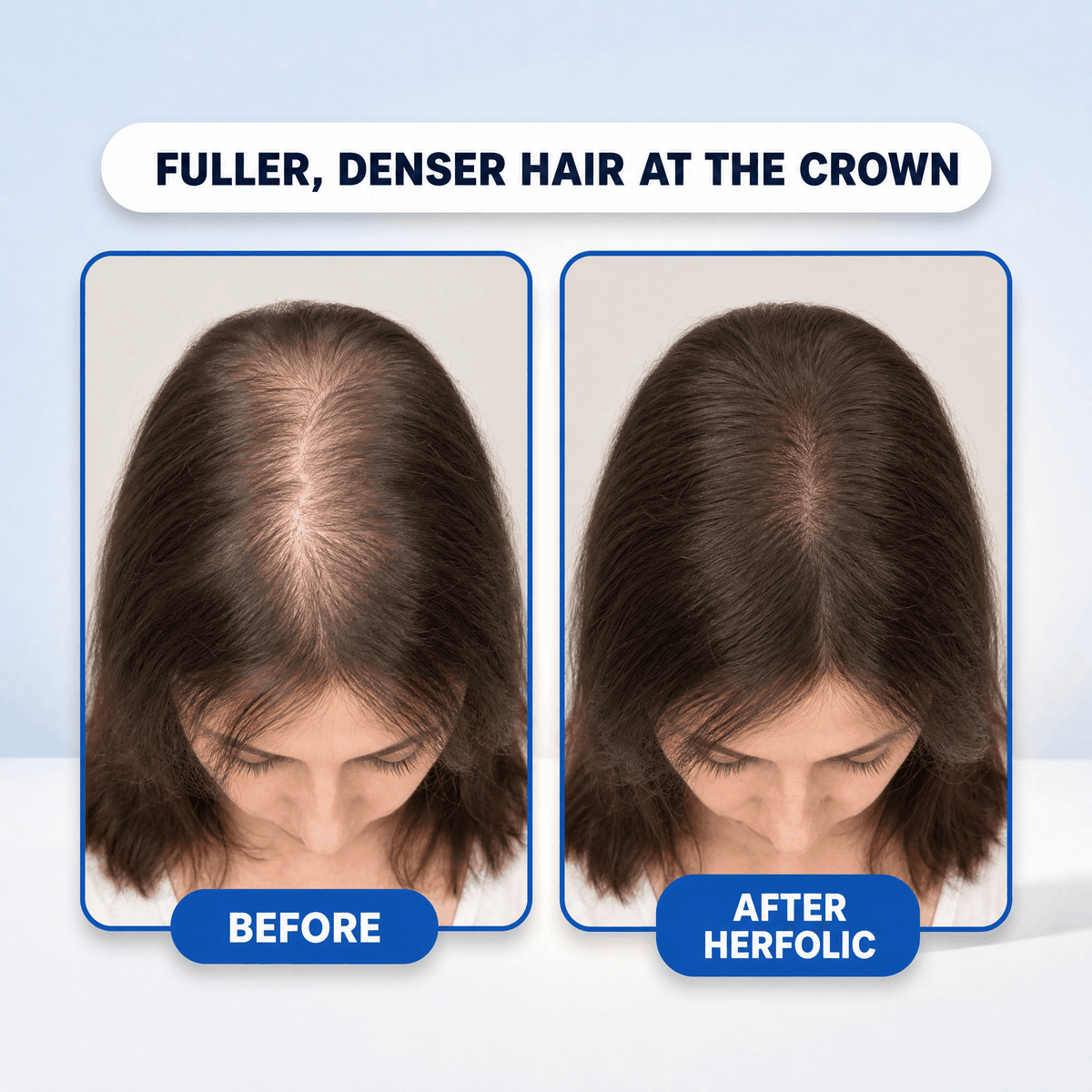 Peptide Infusion Hair Regrowth System